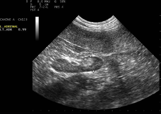 leftadrenal.jpg